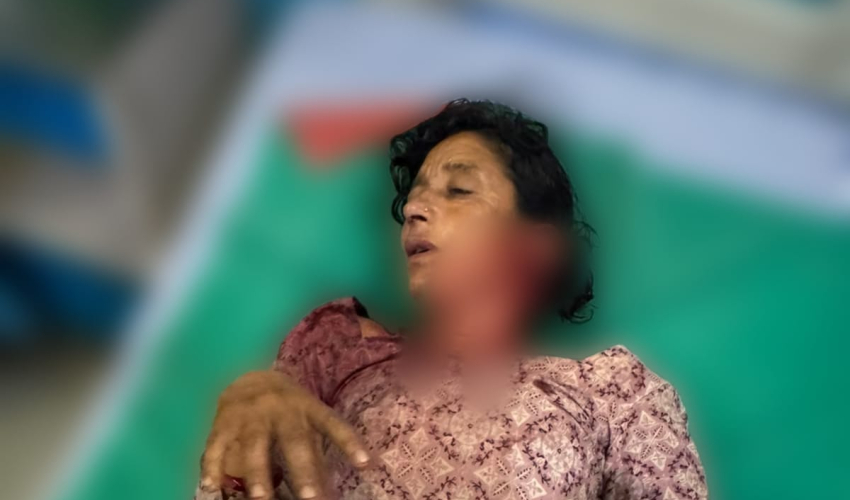 कञ्चनपुरमा बाघको आक्रमणबाट महिला घाइते, धनगढीमा उपचार हुँदै